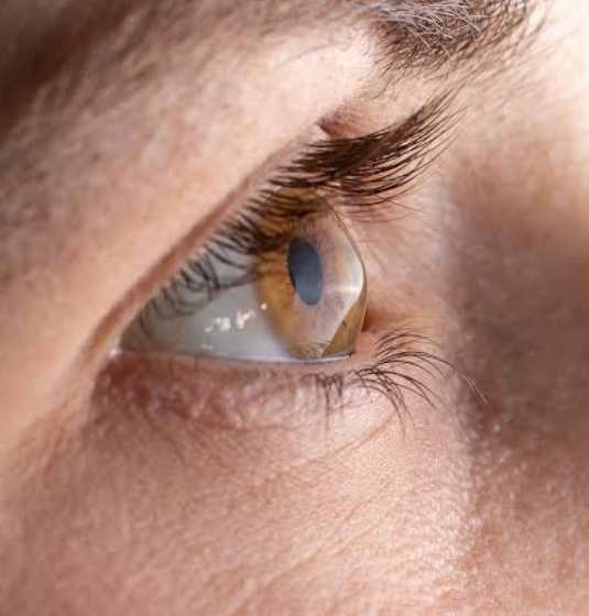 Cornea and Keratoconus Services